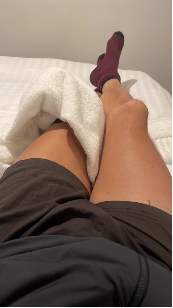 The Backbone - a photo of Bill's legs wearing shorts, lying on a bed with a towel covering an ice pack on his left knee